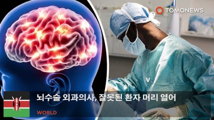 뇌수술 외과의사, 잘못된 환자 머리 열어