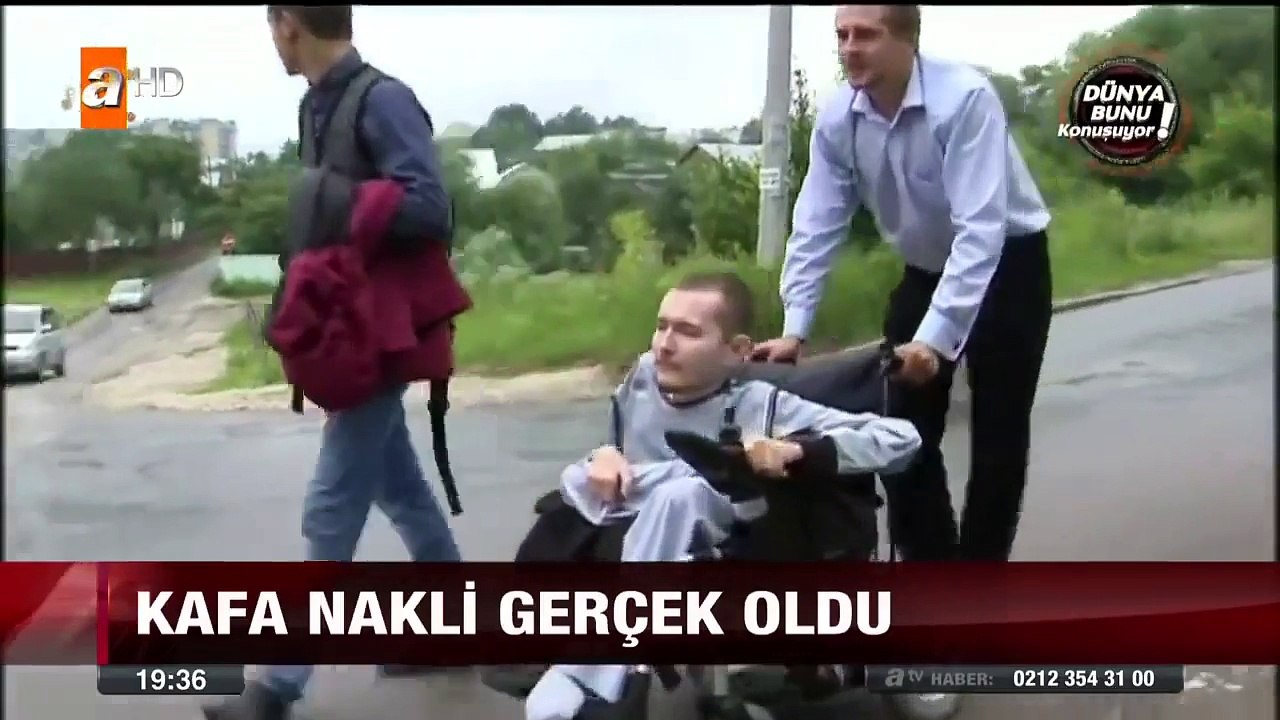 İlk kafa nakli yapıldı