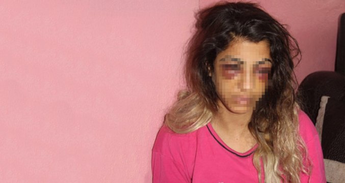 Aldatıldı Yetmedi, Kocasını Terk Edince Bir de Sokak Ortasında Tekme Tokat Dayak Yedi