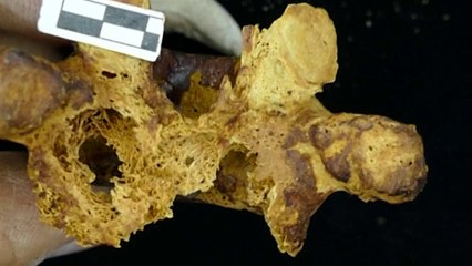 أقدم حالات الإصابة بالسرطان تُكتشف في بعض الموميات