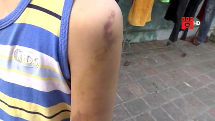 BÉ TRAI BỊ BẦM DẬP VÌ BỊ BỐ ĐẺ VÀ MẸ KẾ BẠO HÀNH