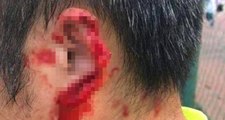Çin'de Futbolcu Kavga Ettiği Rakibinin Kulağını Isırarak Kopardı