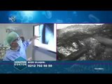 Op. Dr. Onur Kulaksızoğlu | Narkozsuz belfıtığı ameliyatı | 18.12.2017