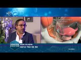 Doç. Dr. Murat Naki | Rahim ağzı kanseri | 13.12.2017