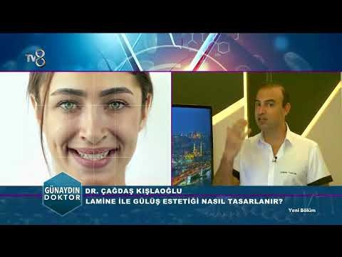 Bir Günde Yapılan Gülüş Tasarımı ve Kullanılan Yöntemler | Günaydın Doktor