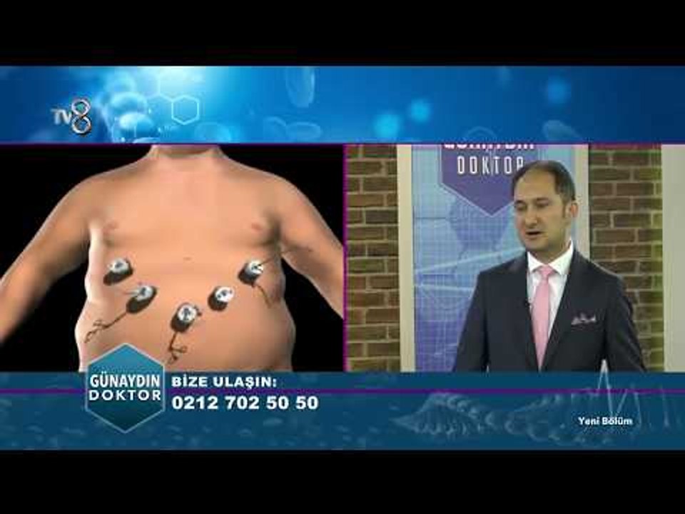 Tüp Mide Ameliyatı Nedir? | Günaydın Doktor