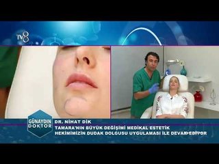 Dudak Dolgusu Yapımı ve Sonrasında Dikkat Edilmesi Gerekenler | Günaydın Doktor