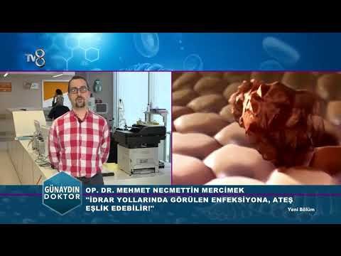 Böbrek Taşı Sebepleri ve Tedavi Yöntemleri | Günaydın Doktor