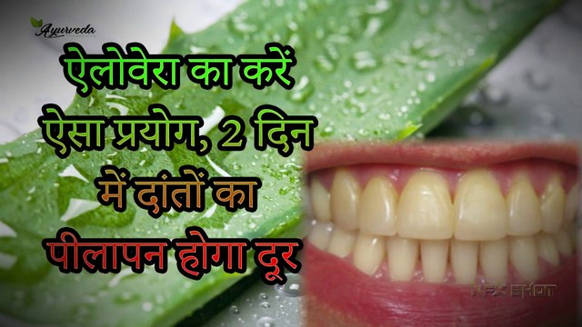 Aloe Vera Benefits ऐलोवेरा से 2 दिन में दांतों का पीलापन दूर Indian Ayurveda The Science Of life