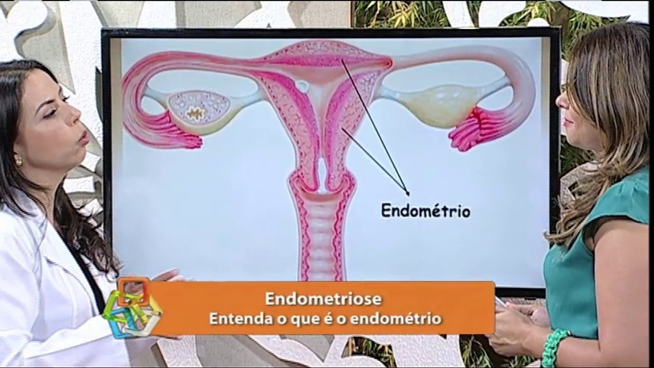 Endometriose