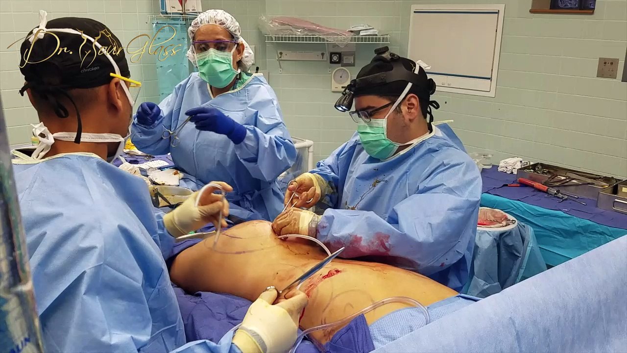 Buttock Implants Post-Op Care