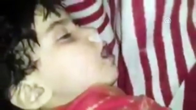 Doğu Guta'da kimyasal silah saldırısı (3)