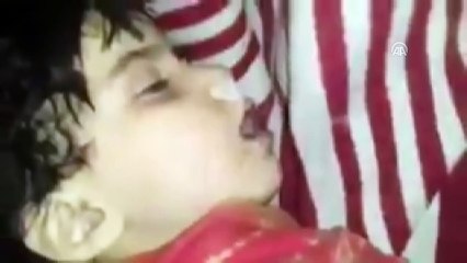 Doğu Guta'da kimyasal silah saldırısı (3)