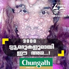 3000 ട്യൂമറുകളുമായി ഈ അമ്മ...!!!