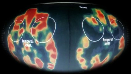 Music video, Adverse Childhood Experiences Can Be Removed (Deliver Us From Evil)