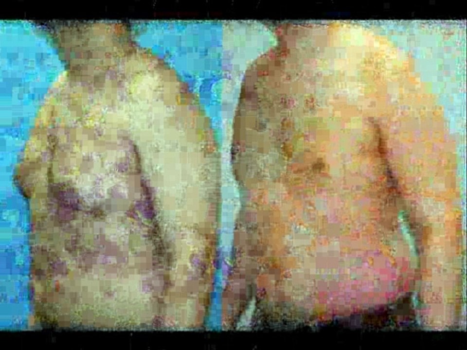 The Real Reason Men Have Nipples and Can They Breast-Feed (You’l