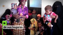 Los yemeníes, refugiados en su propio país