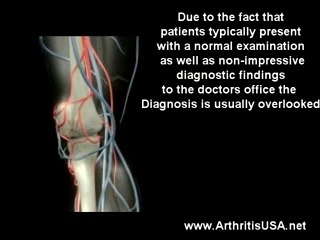 Knee pain from Exertion by Dr Farshchian
