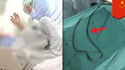 つらい痒みに耐え切れず…iPhone用充電ケーブルを尿道に差し込んだ男性  - トモニュース