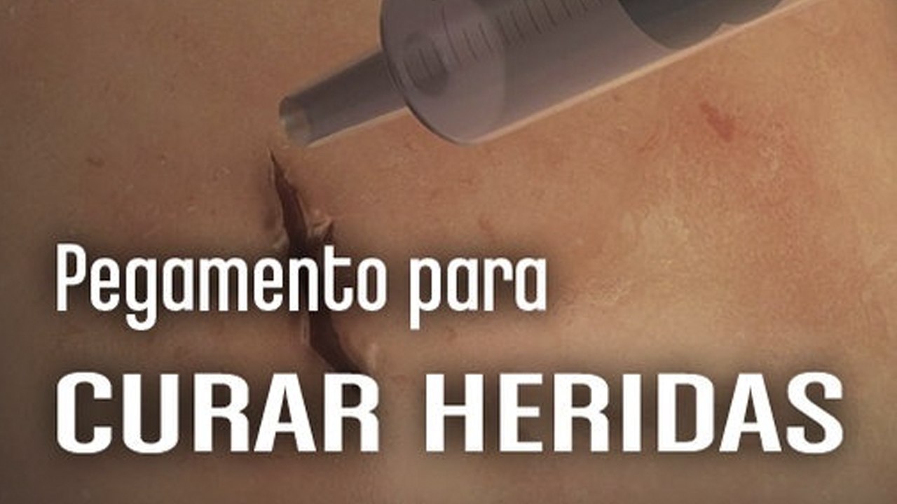 [CH] Pegamento quirúrgico para curar heridas - Vídeo Dailymotion