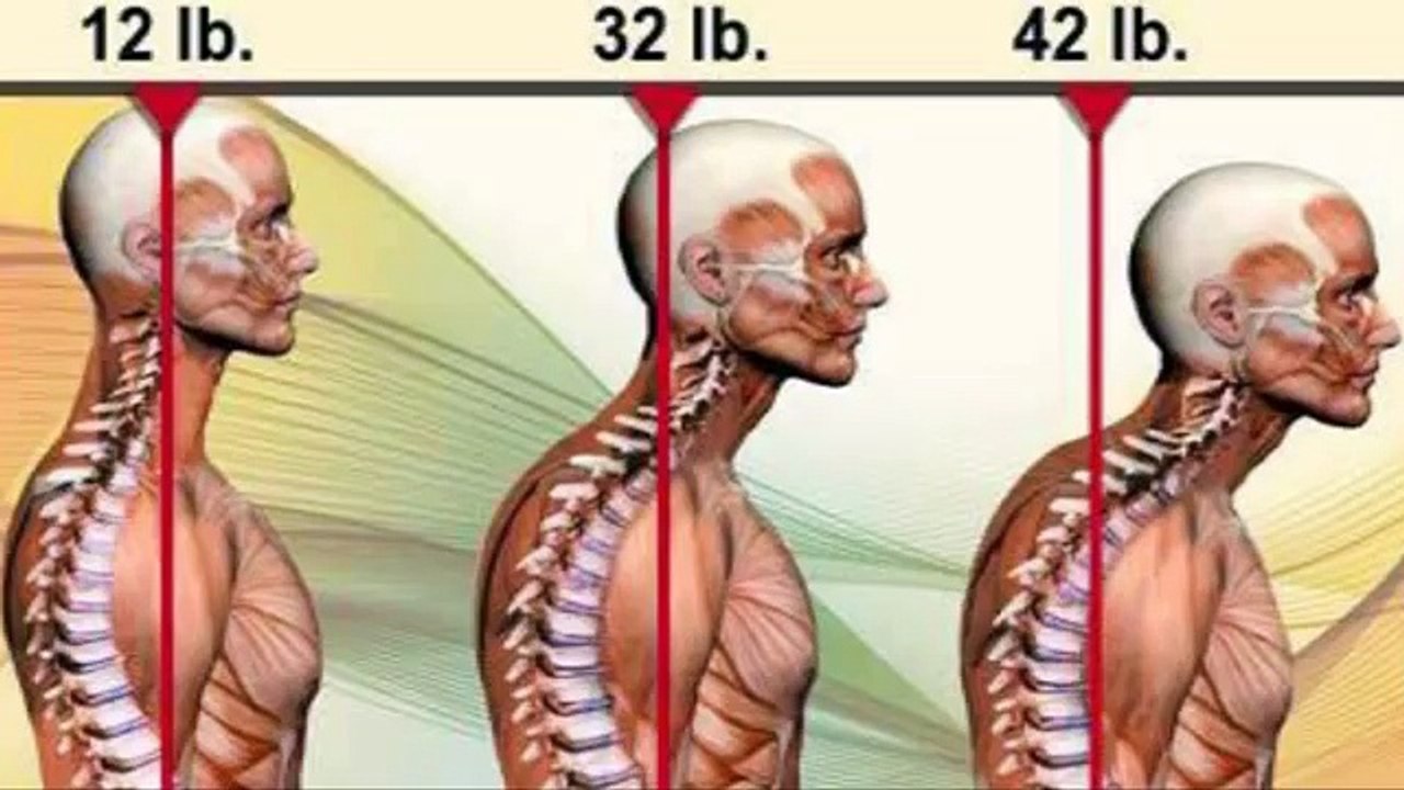 3 Part Exercise to REMOVE Tight Trapezius Muscle in Neck (Neck Pain & Pinched Nerve) Dr