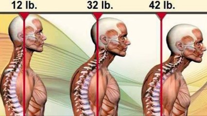 3 Part Exercise to REMOVE Tight Trapezius Muscle in Neck (Neck Pain & Pinched Nerve) - Dr Mandell