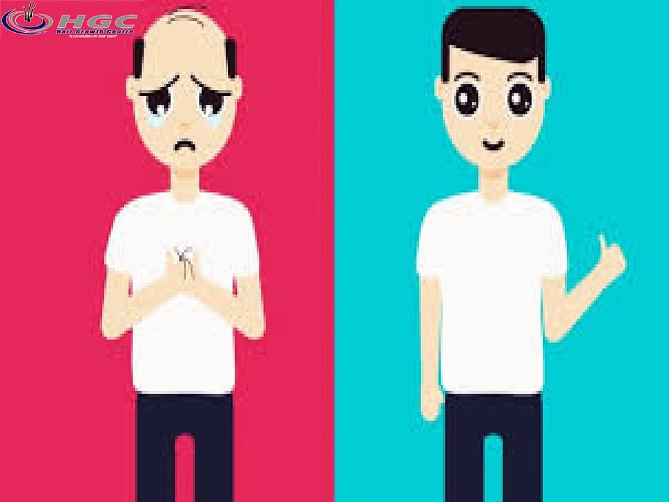 Hairlessness: HOW CLOSE ARE WE TO A CURE?