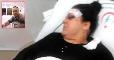 Cani Koca, Boşanma Davası Açan Karısına Tornavida ile Saldırdı