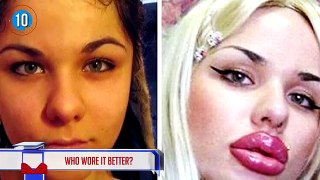 17 plastic surgeries Gone Wrong