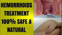 Treating Hemorrhoids Over The Counter - Can Over The Counter Hemorrhoids Treatment Work? | Hemorrhoid Treatment