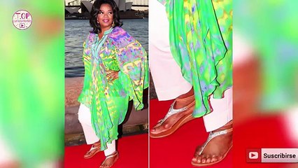 Top 10 Defectos de nacimiento que ocultan los Famosos