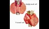 Симптомы и признаки заболевания щитовидной железы