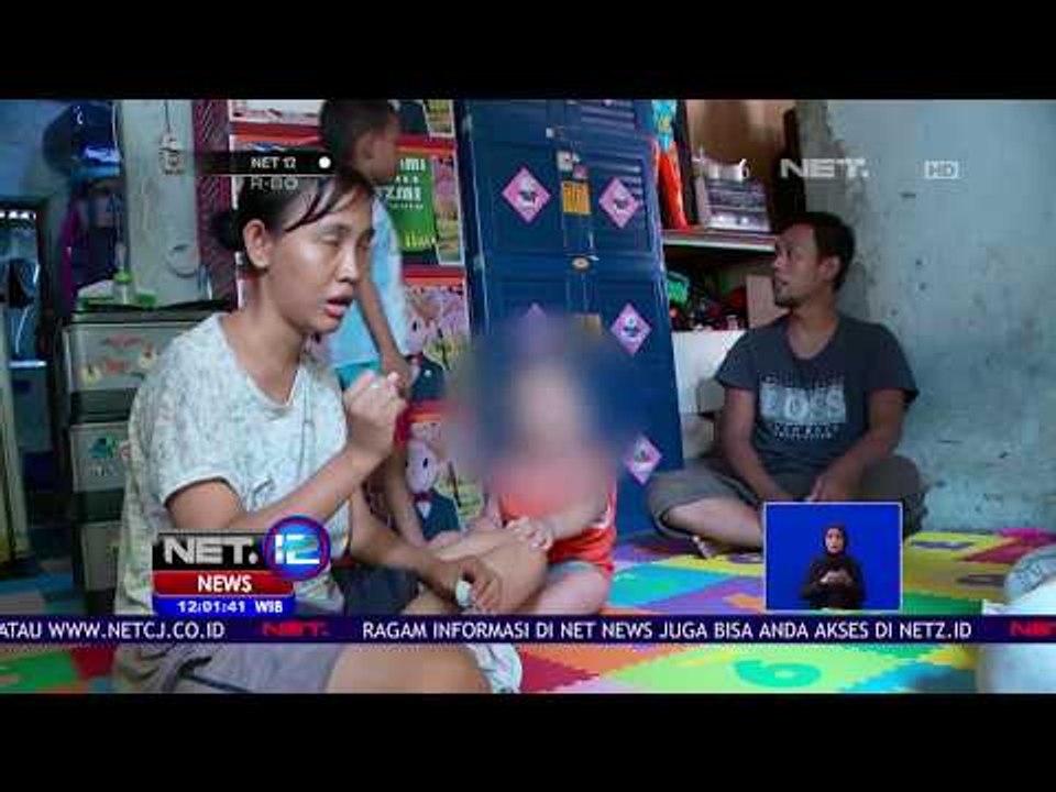 Bayi Lahir Tanpa Mata, Diduga Karena Ibu Kurang Gizi - NET 12