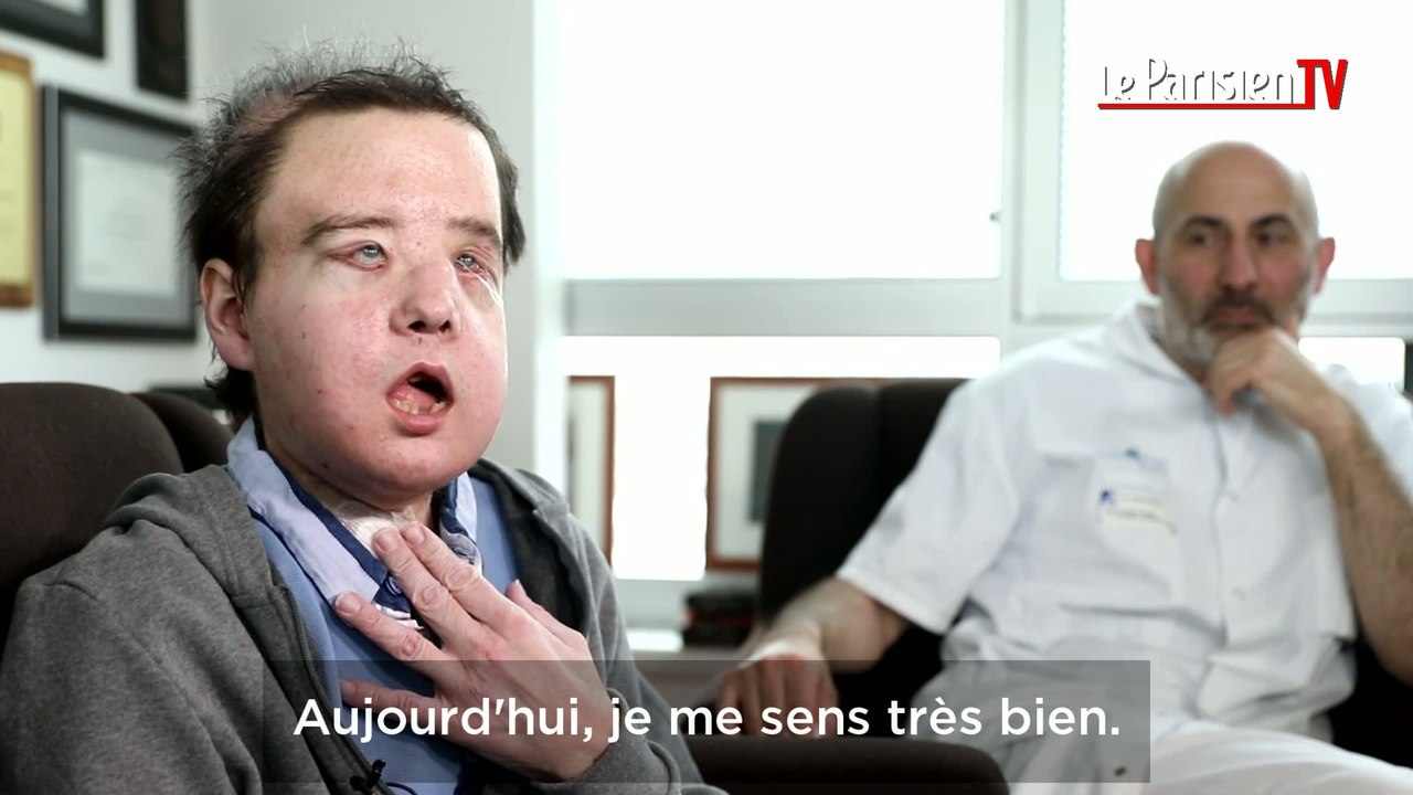 Jérôme l'homme qui s'est fait greffer deux visages