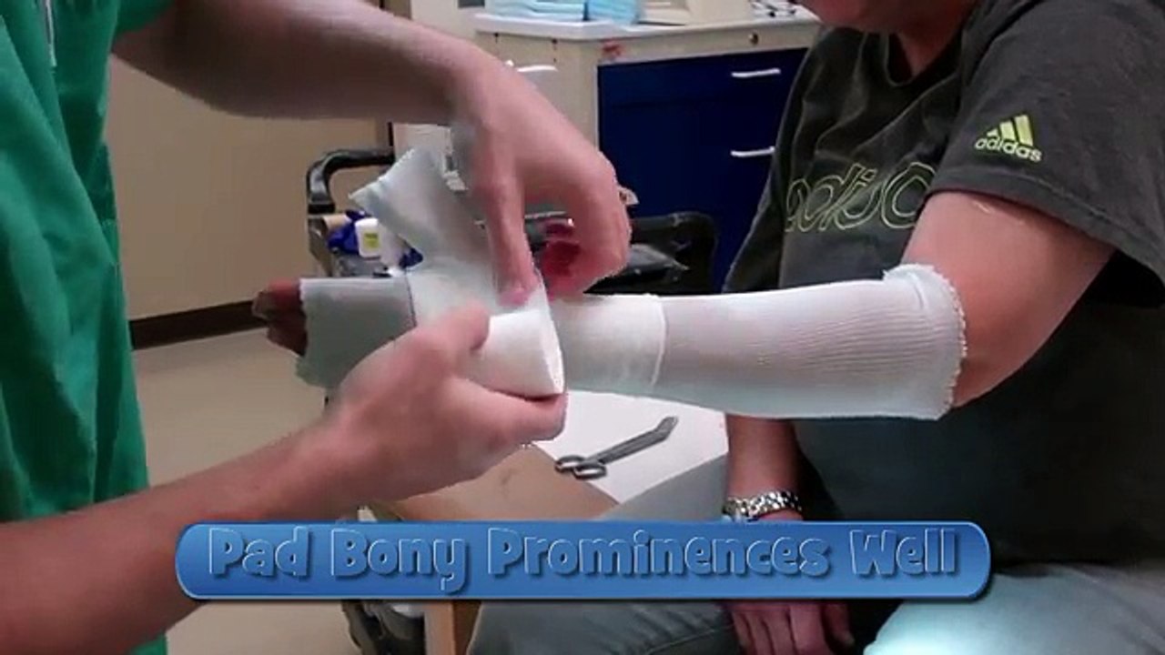 Application of a Thumb Spica Cast video Dailymotion