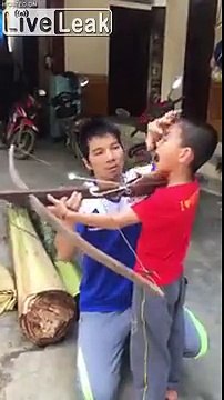 Enlever une dent.. avec une ARBALETE !! Le gamin est fou...