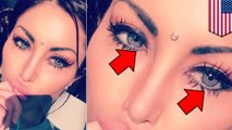 Instagram model ruins vision after undergoing risky eye operation