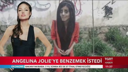 Angelina Jolie'ye benzemek istedi ama...