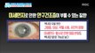 [Happyday]Dry eye syndrome, blindness?! 안구건조증,   방심하면 실명?![기분 좋은 날] 20180417