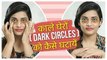 काले घेरों से कैसे छुटकारा पाएं | Dark Circles Under Eyes Home Remedy | Dark Circles Kaise Hataye?