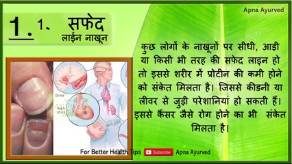 नाखून बताते है आपके छुपे रोग || Nails Explain Your Hidden Disease || Apna Ayurved