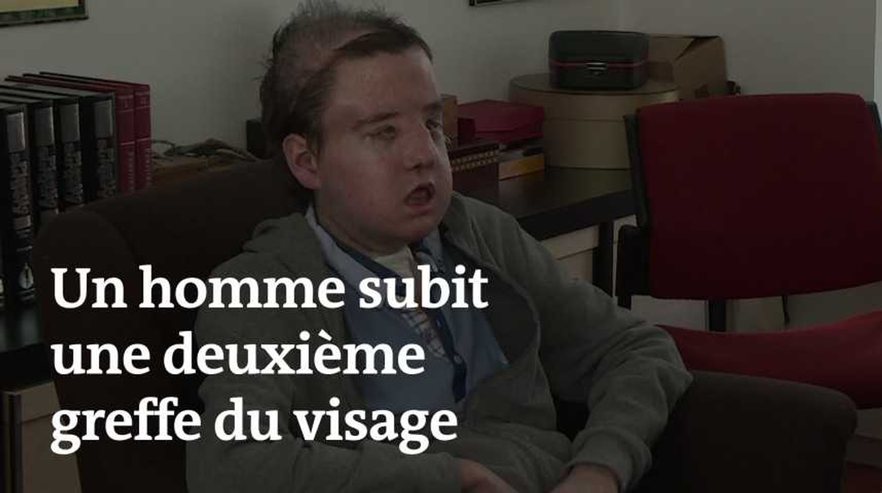 Greffé pour la seconde fois du visage, Jérôme Hamon dit se sentir « très bien »
