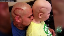 Padre se tatúa una cicatriz en la cabeza para darle valor a su hijo con cáncer en el cerebro