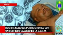 Brasileño con un cuchillo clavado en su cabeza conduce por más de dos horas hasta un hospital
