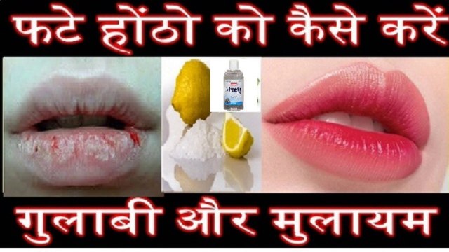 रूखे, फटे, पपड़ीदार होंठों को मुलायम गुलाबी बनाने के असरदार घरेलू उपाय Home Remedies For Chapped Lips