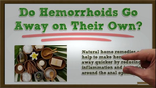 How Long Do Hemorrhoids Last - How Long Do Hemorrhoids Last Without & With Hemorrhoid Treatment? | Hemorrhoid Treatment