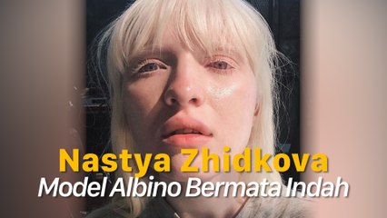 Nastya Zhidkova, Model Albino Bermata Indah