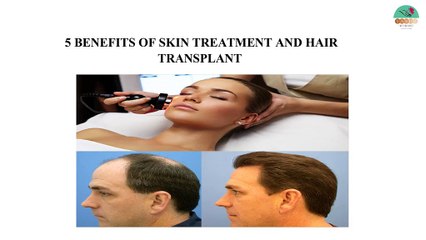 5 benefits of skin treatment  and hair transplant