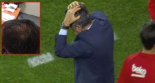 Fenerbahçe Maçında Çıkan Olaylarda Yaralanan Şenol Güneş'in Kafasına Dikiş Atıldı