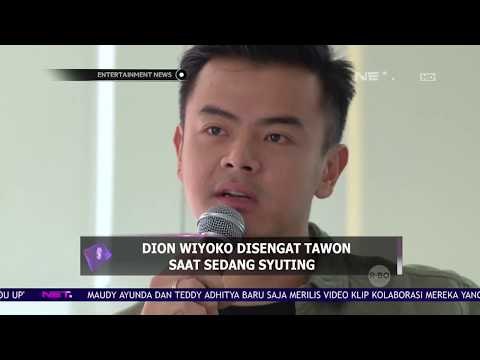 Dion Wiyoko Disengat Tawon Saat Sedang Syuting
